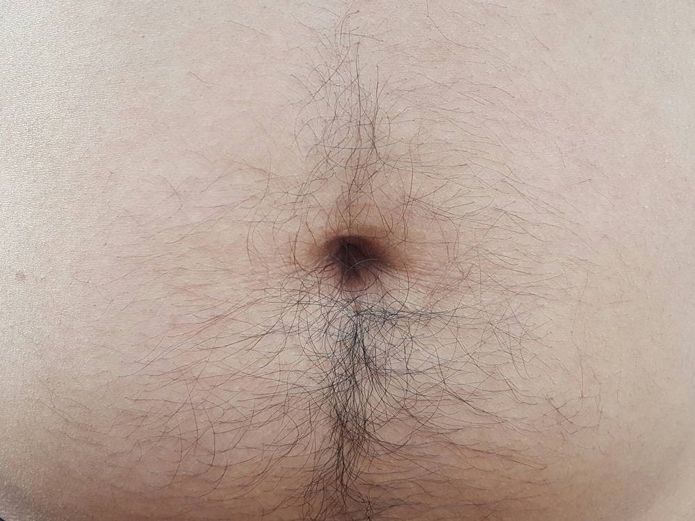 What is a FUPA? How to Get Rid of It?