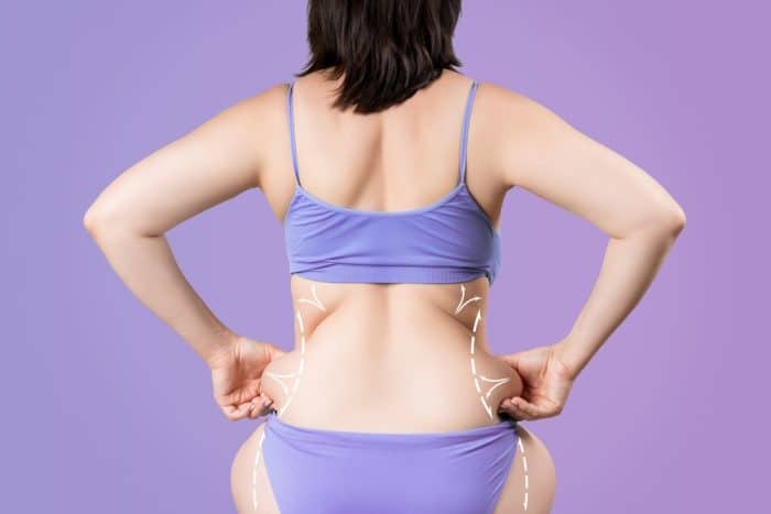 Rear-view of woman holding her love handles with a dashed line showing the form that she aspires to.