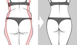 Drawing showing a rear view of a woman's before and after results.